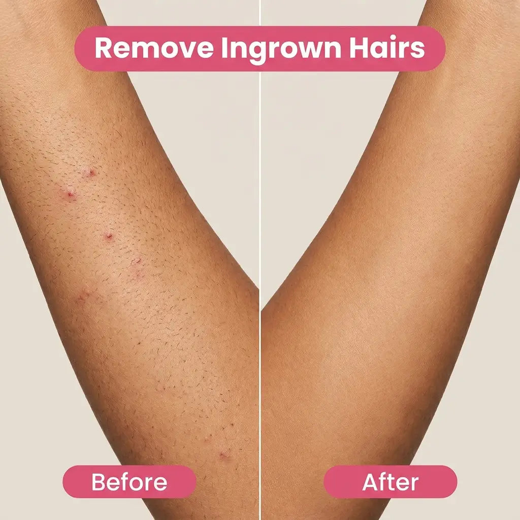 BareBabe™ - Bikini & Body Trimmer 2.0
