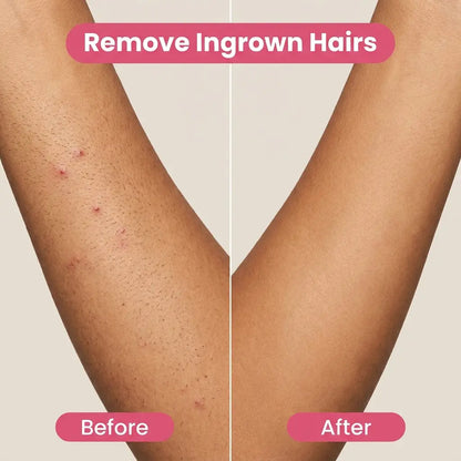 BareBabe™ - Bikini & Body Trimmer 2.0